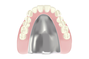 チタン義歯