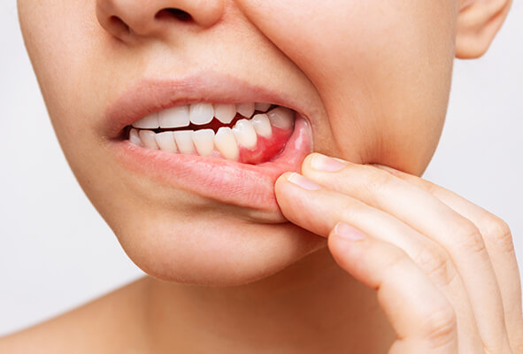 歯周病は全身に影響を及ぼす怖い病気です