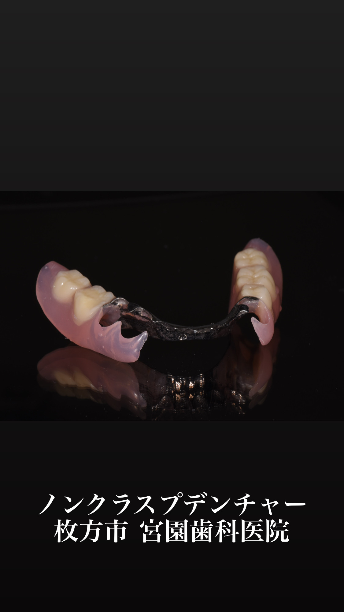 ノンクラスプデンチャー(入れ歯に見えない入れ歯)