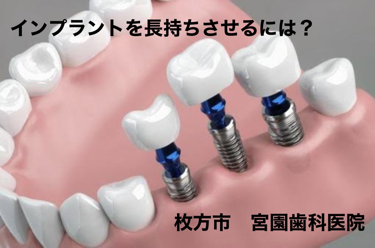 インプラントを長持ちさせる要素